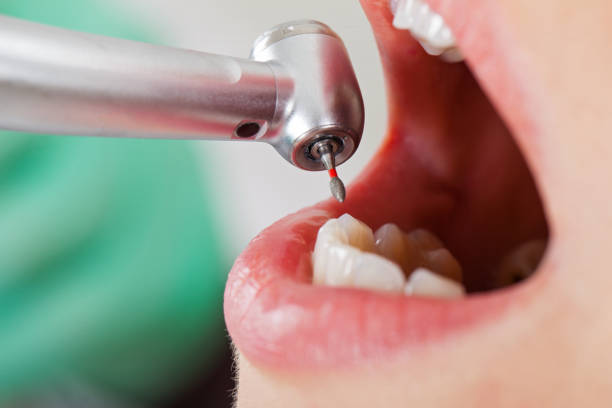 Best Emergency Treatment for Oral Infections in Hamilton Square, NJ